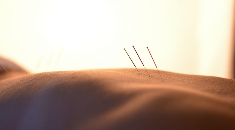 acupuntura benestar benetusser valencia